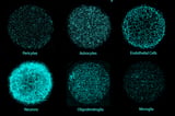 Lab-grown brains with all major cell types support next-generation therapy research