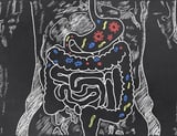 Researchers call for microbiome moonshot to tackle chronic diseases
