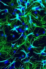 Study sheds light on how pediatric brain tumors grow