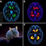 Stem Cell Transplant Promotes Brain Cell Regeneration and Functional
