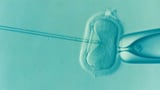 Federal police investigating Genea Fertility cyber attack