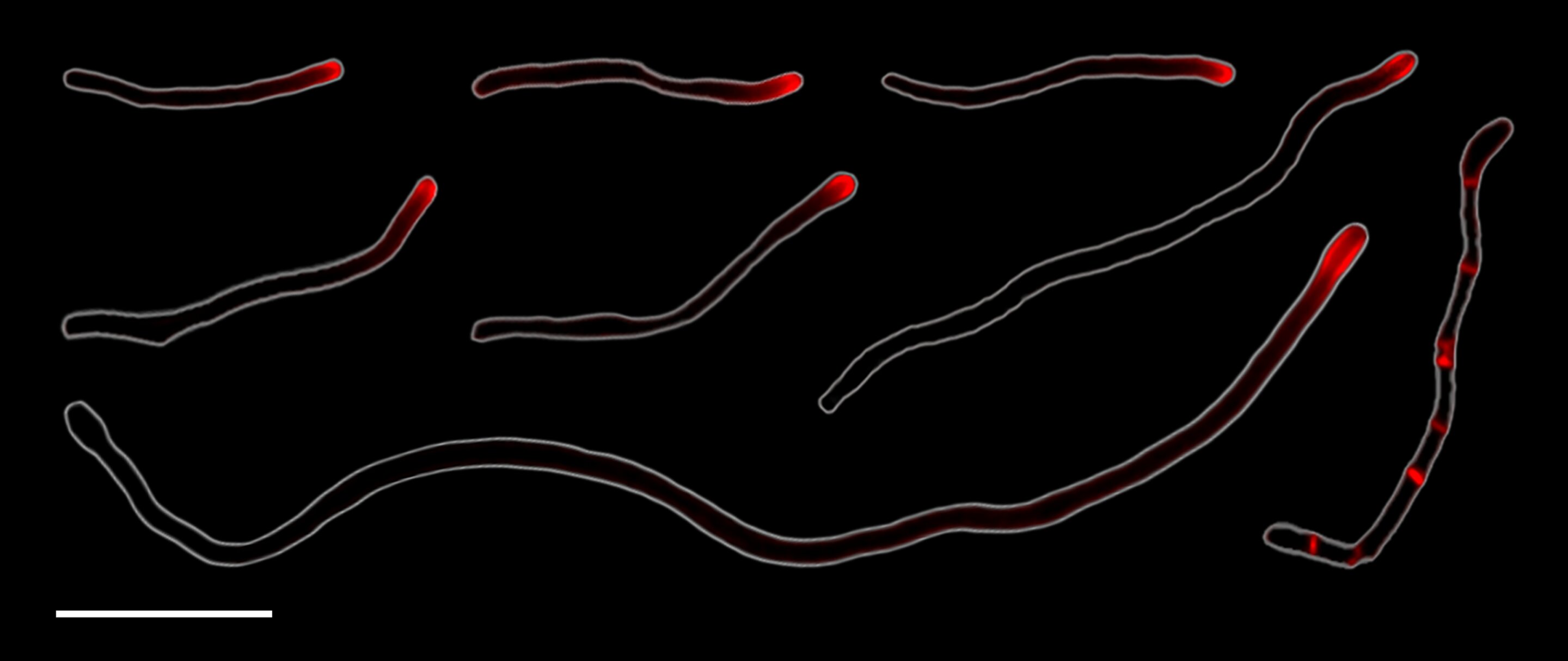 Human mouth bacteria reproduce through rare form of cell division, research reveals