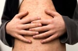 US measles cases are already triple those of last year