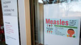 Measles cases surpass 900 in US as infections confirmed in 29 states, CDC data shows