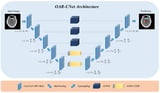 OAR-UNet: Enhancing Long-Distance Dependencies for Head and Neck OAR Segmentation