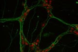 Gut neurons help the body fight inflammation