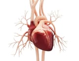 Heart attacks in women under age 65 are caused by factors other than clogged arteries
