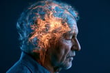 Midlife Vascular Health Adds Nearly 13 Dementia-Free Years