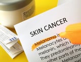 AI model enhances early detection of skin cancer with high accuracy