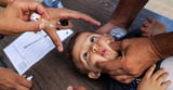 The Pivotal Decision That Led to a Resurgence of Polio