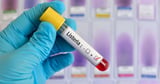 Everything we know as listeria outbreak at NHS hospitals kills 3 – including regions affected