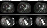 New AI tool to set new standards in MRI image segmentation