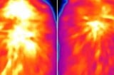 Novel way to ‘rev up’ brown fat burns calories, limits obesity in mice