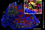 Preventing corruption in the lymph nodes