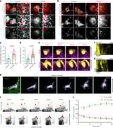 How the body's cells change shape to deal with wounds