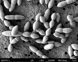 Japan researchers identify gut bacteria strain that boosts anticancer drugs
