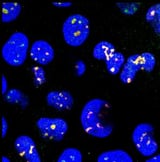 Nuclear speckle rejuvenation “next frontier” for treating neurodegeneration