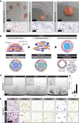 Finding new treatments for genetic tumor-predisposition syndrome