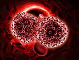 New lab model brings hope for aggressive blood cancer research