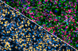 UCLA scientists build ‘cell villages’ to map the genetics of brain cell fitness | Newswise