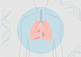 Collaboration leads to drug candidate for a hard-to-treat type of lung cancer