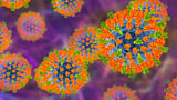 Measles could again become widespread as cases surge worldwide