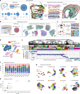 Cell atlas of the developing human meninges reveals a dura-like nature of meningiomas