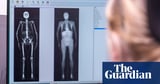 Full-body scans of 100,000 people could change way diseases are detected and treated