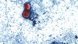 US officials declare an end to record-setting cyclospora outbreak, but its origin is still unknown