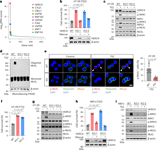 HERC4-mediated ubiquitination licenses RIPK1 to initiate TNF-induced cell death