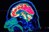 Scientists measure exact speed of human thought – the results are surprising