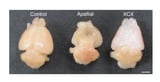 Scientists transplant lab-grown human brain tissue into mice