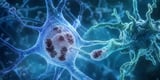 Oxford researchers discover how microglia remove α-synuclein aggregates — News-Medical