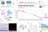 Spatially resolved multiomics of human meningeal development reveal lineage and disease dynamics