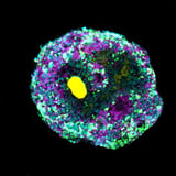 New molecular engineering technique allows for complex organoids