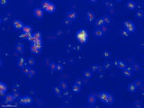 New AI Tool Reveals How Drugs Kill Tuberculosis | Newswise