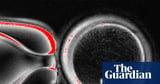 Human skin cells are turned into eggs in fertility breakthrough