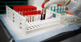Blood test added to US colorectal cancer screening options