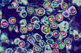 U.S. Measles Cases Are Rising in 2024, CDC Warns