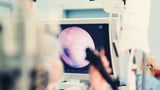 As AI spreads through health care, is the technology degrading providers’ skills?