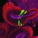 Ribosome level changes detected in early brain development