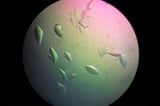 Researchers discover protein that prevents DNA damage