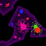 Tuft Cell-Like Tumors Reveal New Cancer Subtype With Distinct Biology,