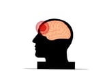 Traumatic brain injuries in older adults linked to increased risk of dementia
