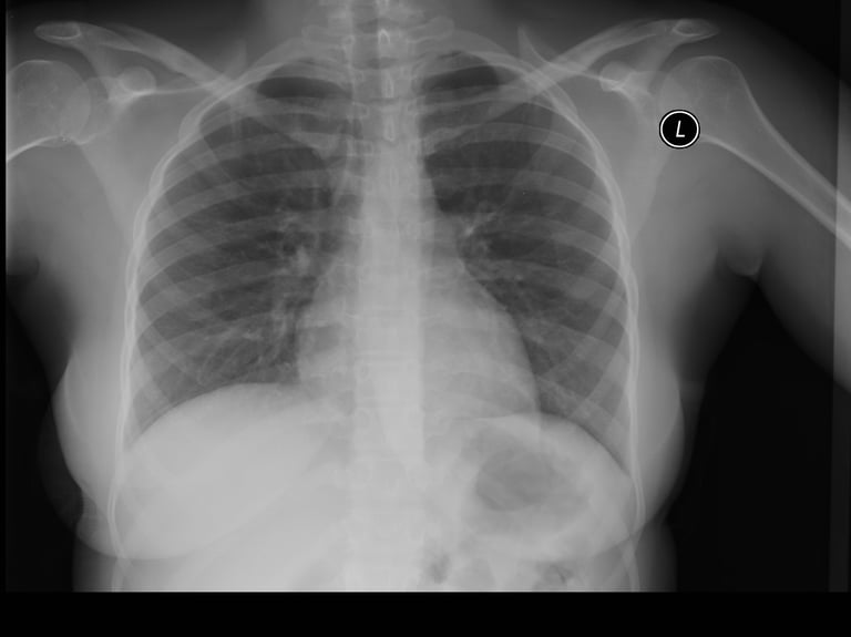 UTS Develops AI System with 98% Accuracy in Detecting COVID-19 from X-Rays