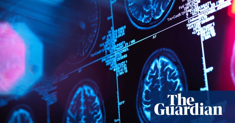 Stanford Scientists Develop Blood Test to Reveal Organ Age, Potentially Predict Disease Risk
