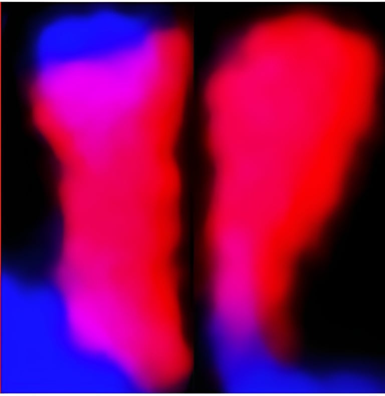 Genetic Differences in American and Chinese Chestnuts Could Impact Blight Resistance Efforts