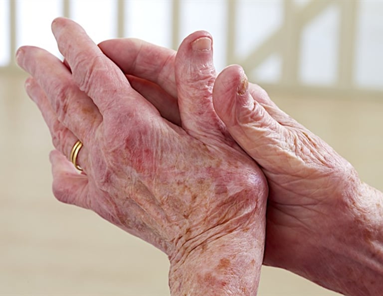 Revolutionary 10-Minute Test for Arthritis Diagnosis Developed by Korean Scientists