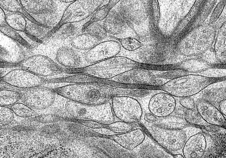 Breakthrough Study Unveils Pearls-on-a-String Axon Structure Boosting Neuronal Signaling