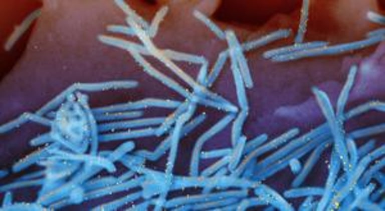 EU Urges Enhanced RSV Immunisation to Shield Infants Amid Rising Hospitalizations